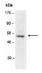 DNA Nucleotidylexotransferase antibody, orb66909, Biorbyt, Western Blot image 