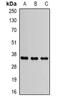 Solute Carrier Family 25 Member 4 antibody, orb340790, Biorbyt, Western Blot image 