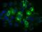 Thromboxane A Synthase 1 antibody, MA5-25166, Invitrogen Antibodies, Immunocytochemistry image 