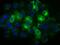 Thromboxane A Synthase 1 antibody, MA5-25166, Invitrogen Antibodies, Immunocytochemistry image 