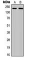 Colony Stimulating Factor 1 Receptor antibody, LS-C355980, Lifespan Biosciences, Western Blot image 