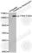 Tyrosine Kinase 2 antibody, AP0466, ABclonal Technology, Western Blot image 