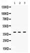 DNA Polymerase Beta antibody, PA5-79842, Invitrogen Antibodies, Western Blot image 