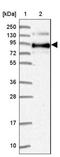 Solute Carrier Family 39 Member 6 antibody, NBP2-13337, Novus Biologicals, Western Blot image 