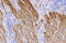 Actin Alpha 2, Smooth Muscle antibody, GTX629702, GeneTex, Immunohistochemistry paraffin image 