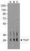 T Cell Immunoreceptor With Ig And ITIM Domains antibody, LS-C669098, Lifespan Biosciences, Western Blot image 