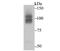 ALC1 antibody, A05749-1, Boster Biological Technology, Western Blot image 