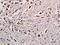 Polyubiquitin antibody, PA5-72439, Invitrogen Antibodies, Immunohistochemistry paraffin image 