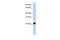 ADP Ribosylation Factor Like GTPase 8A antibody, GTX45736, GeneTex, Western Blot image 