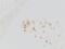 CD207 Molecule antibody, NB100-56733, Novus Biologicals, Immunohistochemistry paraffin image 