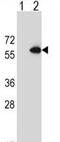 Cystathionine-Beta-Synthase antibody, ab135626, Abcam, Western Blot image 