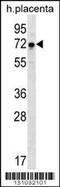 Glucosamine (UDP-N-Acetyl)-2-Epimerase/N-Acetylmannosamine Kinase antibody, 56-322, ProSci, Western Blot image 