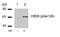 CAMP Responsive Element Binding Protein 1 antibody, PA5-37528, Invitrogen Antibodies, Western Blot image 