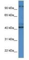 ATCAY Kinesin Light Chain Interacting Caytaxin antibody, NBP1-74085, Novus Biologicals, Western Blot image 