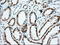 Insulin Like Growth Factor 2 MRNA Binding Protein 2 antibody, LS-C115284, Lifespan Biosciences, Immunohistochemistry frozen image 