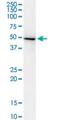 Adenylosuccinate Synthase Like 1 antibody, H00122622-M01, Novus Biologicals, Western Blot image 