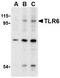 Toll Like Receptor 6 antibody, TA306271, Origene, Western Blot image 