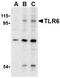 Toll-like receptor 6 antibody, TA306271, Origene, Western Blot image 