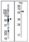 Signal Transducing Adaptor Molecule antibody, AP12103PU-N, Origene, Western Blot image 