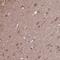 Acyl-CoA Thioesterase 6 antibody, NBP2-31708, Novus Biologicals, Immunohistochemistry frozen image 