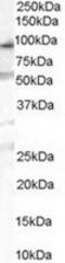 OSBP9 antibody, TA303066, Origene, Western Blot image 