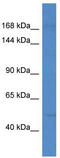 KIAA1757 antibody, TA331038, Origene, Western Blot image 