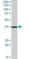 Cysteine Rich With EGF Like Domains 2 antibody, H00079174-B01P, Novus Biologicals, Western Blot image 