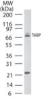 Tax1 Binding Protein 1 antibody, NB600-975, Novus Biologicals, Western Blot image 