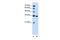 Solute Carrier Family 25 Member 29 antibody, GTX46852, GeneTex, Western Blot image 