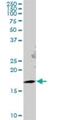 Gem Nuclear Organelle Associated Protein 6 antibody, H00079833-B01P, Novus Biologicals, Western Blot image 