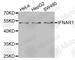 Interferon Alpha And Beta Receptor Subunit 1 antibody, A1715, ABclonal Technology, Western Blot image 