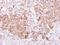 Bone Morphogenetic Protein 15 antibody, NBP2-14888, Novus Biologicals, Immunohistochemistry paraffin image 