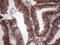 GLI Family Zinc Finger 4 antibody, M15123, Boster Biological Technology, Immunohistochemistry paraffin image 