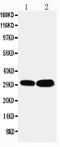 LIM and SH3 domain protein 1 antibody, PA1791-1, Boster Biological Technology, Western Blot image 