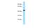 Ankyrin Repeat Domain 33 antibody, A15176, Boster Biological Technology, Western Blot image 