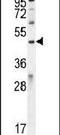 Interaction Protein For Cytohesin Exchange Factors 1 antibody, PA5-24261, Invitrogen Antibodies, Western Blot image 