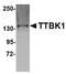Tau Tubulin Kinase 1 antibody, TA306722, Origene, Western Blot image 