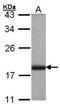 ADP Ribosylation Factor 3 antibody, orb74088, Biorbyt, Western Blot image 