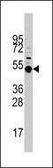 MAP kinase-activated protein kinase 5 antibody, LS-C100742, Lifespan Biosciences, Western Blot image 