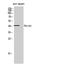 HEXIM P-TEFb Complex Subunit 1 antibody, STJ93494, St John