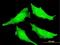 SUMO Specific Peptidase 7 antibody, MA5-22353, Invitrogen Antibodies, Immunofluorescence image 