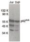 Telomerase protein component 1 antibody, PA5-19860, Invitrogen Antibodies, Western Blot image 