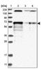 LTV1 Ribosome Biogenesis Factor antibody, PA5-56372, Invitrogen Antibodies, Western Blot image 