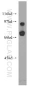 Interleukin 10 Receptor Subunit Alpha antibody, 13356-1-AP, Proteintech Group, Western Blot image 