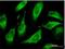 CDP-Diacylglycerol Synthase 1 antibody, H00001040-M01, Novus Biologicals, Immunofluorescence image 