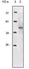 Insulin Like Growth Factor 1 Receptor antibody, NB110-87052, Novus Biologicals, Western Blot image 