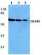 Coenzyme A Synthase antibody, A09138, Boster Biological Technology, Western Blot image 