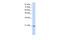 MIF4G Domain Containing antibody, A12167, Boster Biological Technology, Western Blot image 