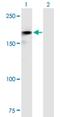 Roundabout homolog 2 antibody, H00006092-B01P, Novus Biologicals, Western Blot image 