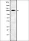 Actinin Alpha 4 antibody, orb336972, Biorbyt, Western Blot image 